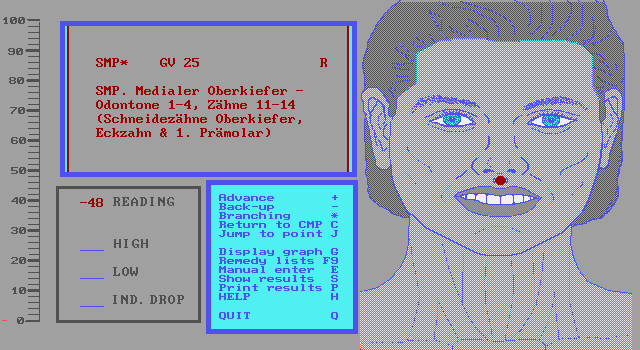 Verzweigung von Ly.2 zum Summationsmepunkt Gouverneur-Gef 25
