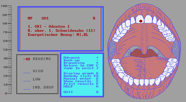 Von GG.25 kann weiter zu den einzelnen Zhnen verzweigt werden