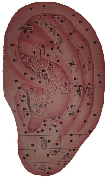 Bild: Ohrakupunktur-Chinesische Punkte